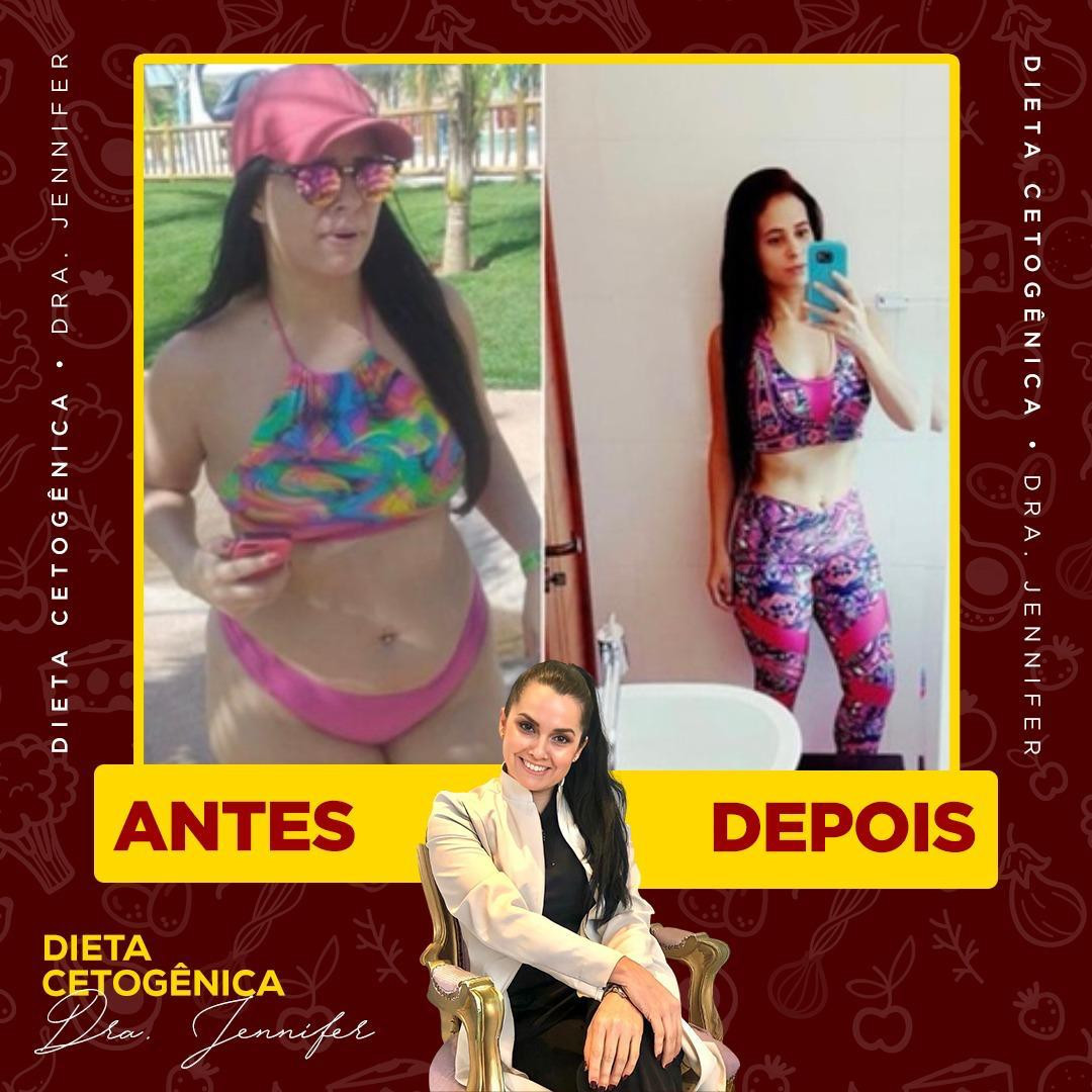 Dieta cetogenica